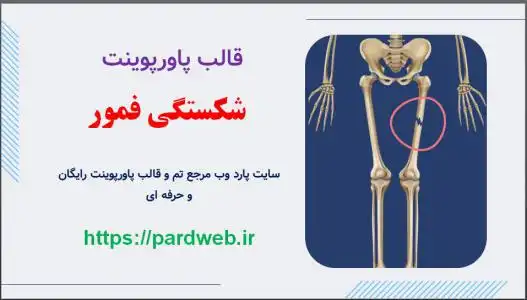 دانلود قالب پاورپوینت شکستگی فمور