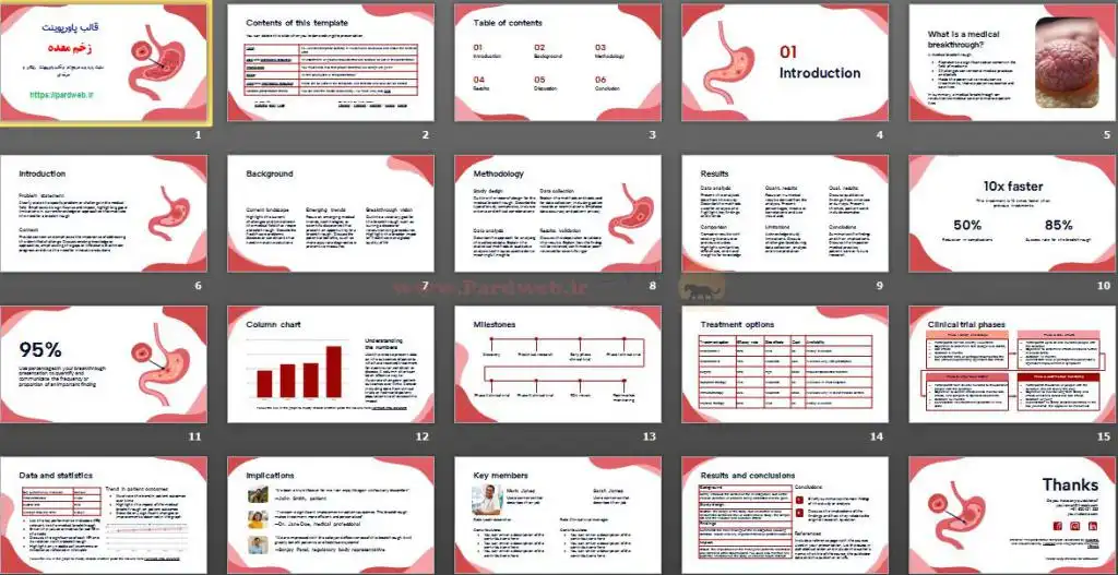 دانلود اسلایدهای قالب پاورپوینت زخم معده
