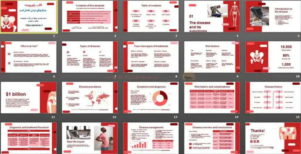 دانلود اسلایدهای قالب پاورپوینت بیماریهای مزمن مفصل هیپ