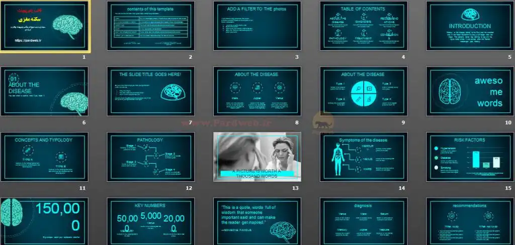 دانلود قالب پاورپوینت سکته مغزی